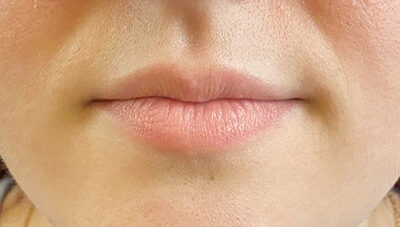 Before